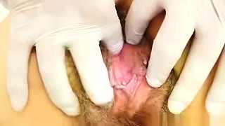 Playful ripe gyno at the clinic